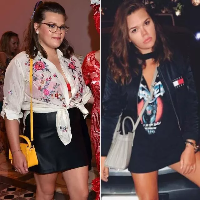 El antes y el después de Camille Gottlieb El antes y el después de Camille Gottlieb