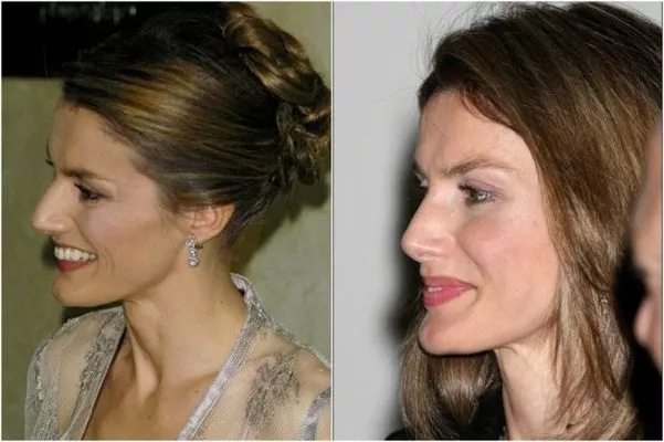 Letizia Letizia