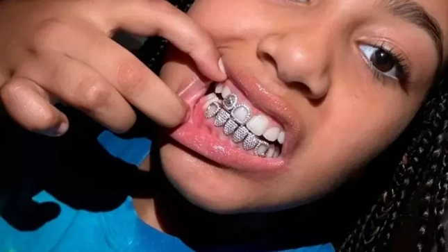 North West y sus dientes North West y sus dientes