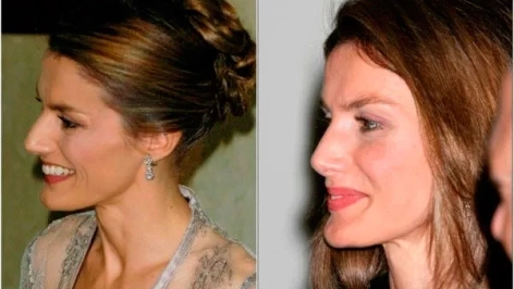 ReinaLetizia antes y después ReinaLetizia antes y después