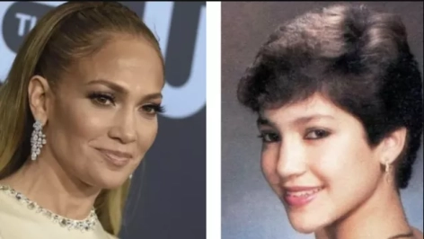 jennifer lópez antes y después 