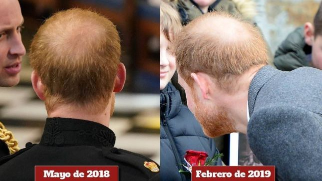 El príncipe Harry antes de pasar por el quirófano El príncipe Harry antes de pasar por el quirófano